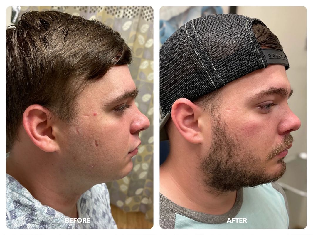 24 year old male with a weak chin and_yythkg (1)